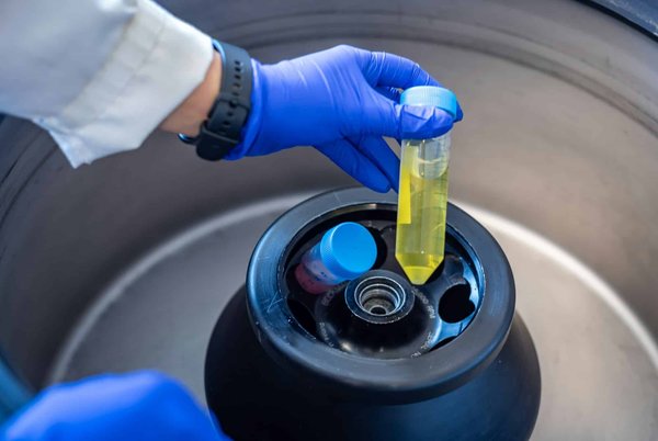 Les avantages d'une centrifugeuse à grande capacité pour des jus en grande quantité